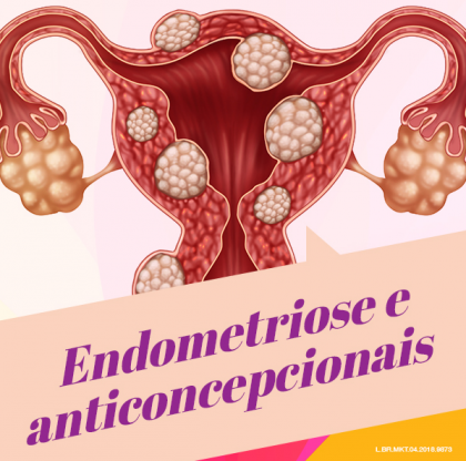 Endometriose E Anticoncepcionais Cl Nica Serpas